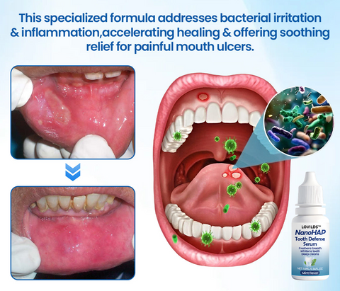 LOVILDS™ NanoHAP Tooth Defense Serum